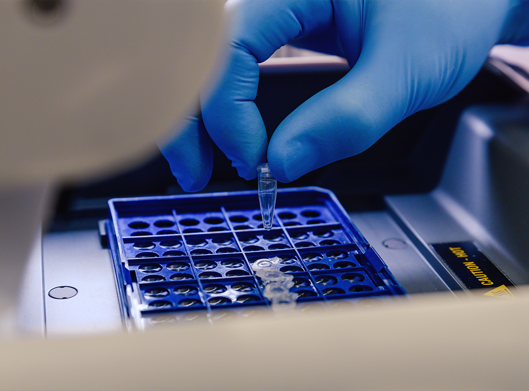 The Benefits of PGS at Vaishanavi Fertility Centre Ambattur